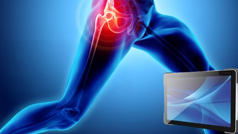 Innovative Hip Surgery System: Boosting Surgical Success